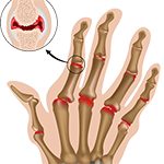 bones
